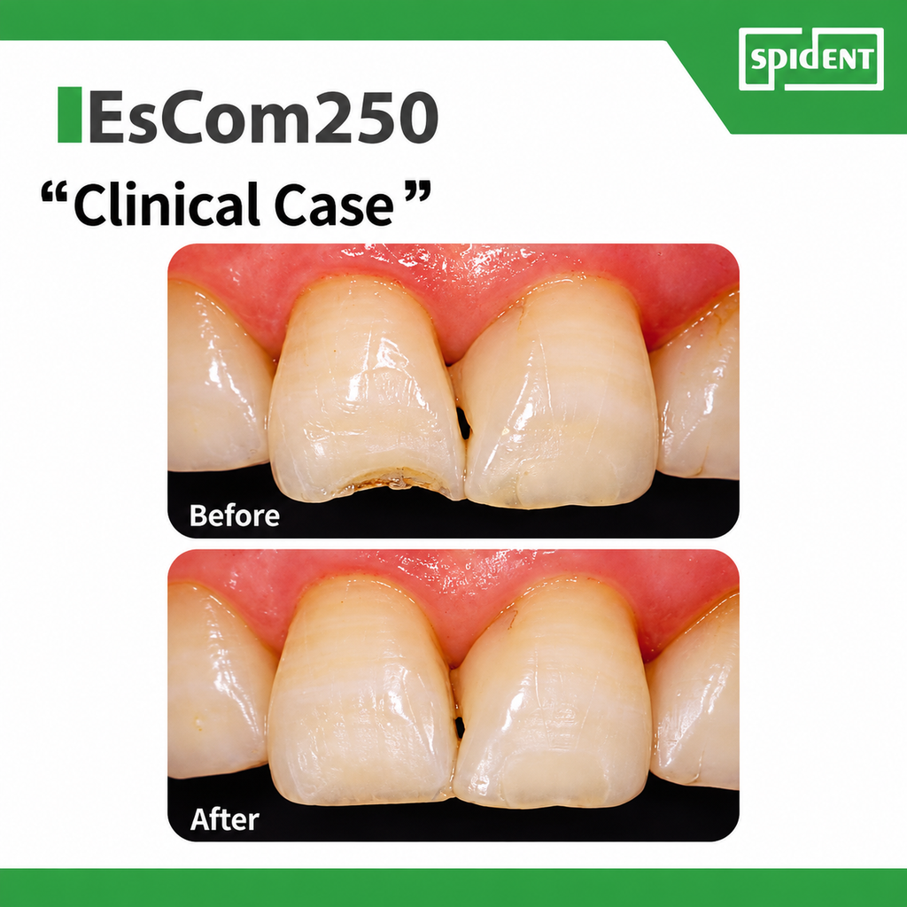 Spident EsCom250 NanoHybrid Composite