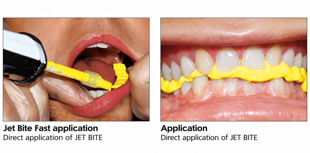 Coltene Jet Bite Silicone Bite Registration