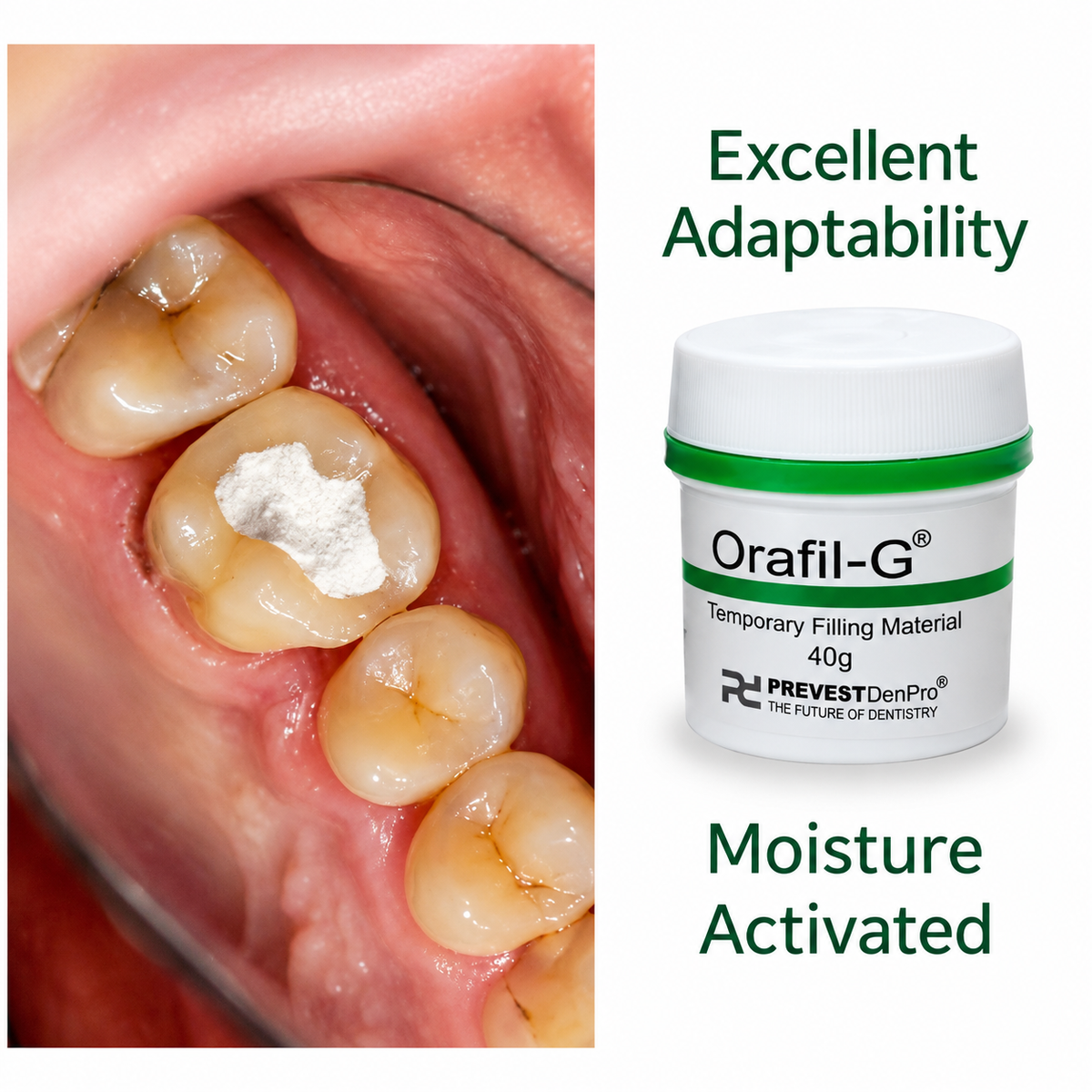 Prevest Orafil G Temporary Filling Material 40g