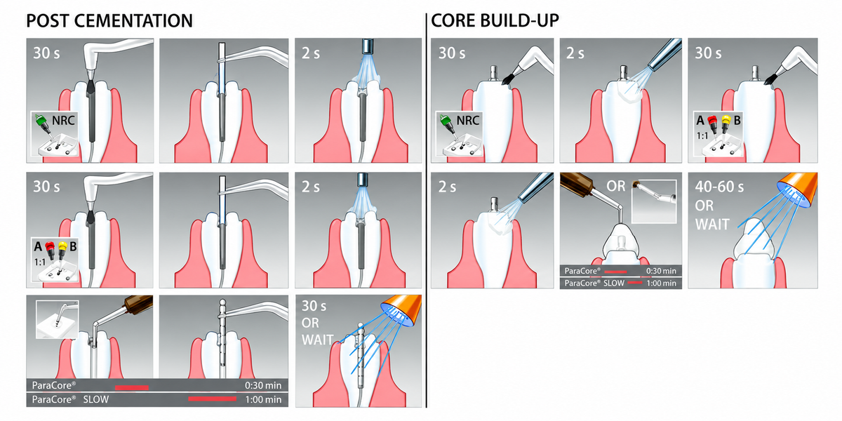 Coltene Paracore Kit (Core Build Up Material)