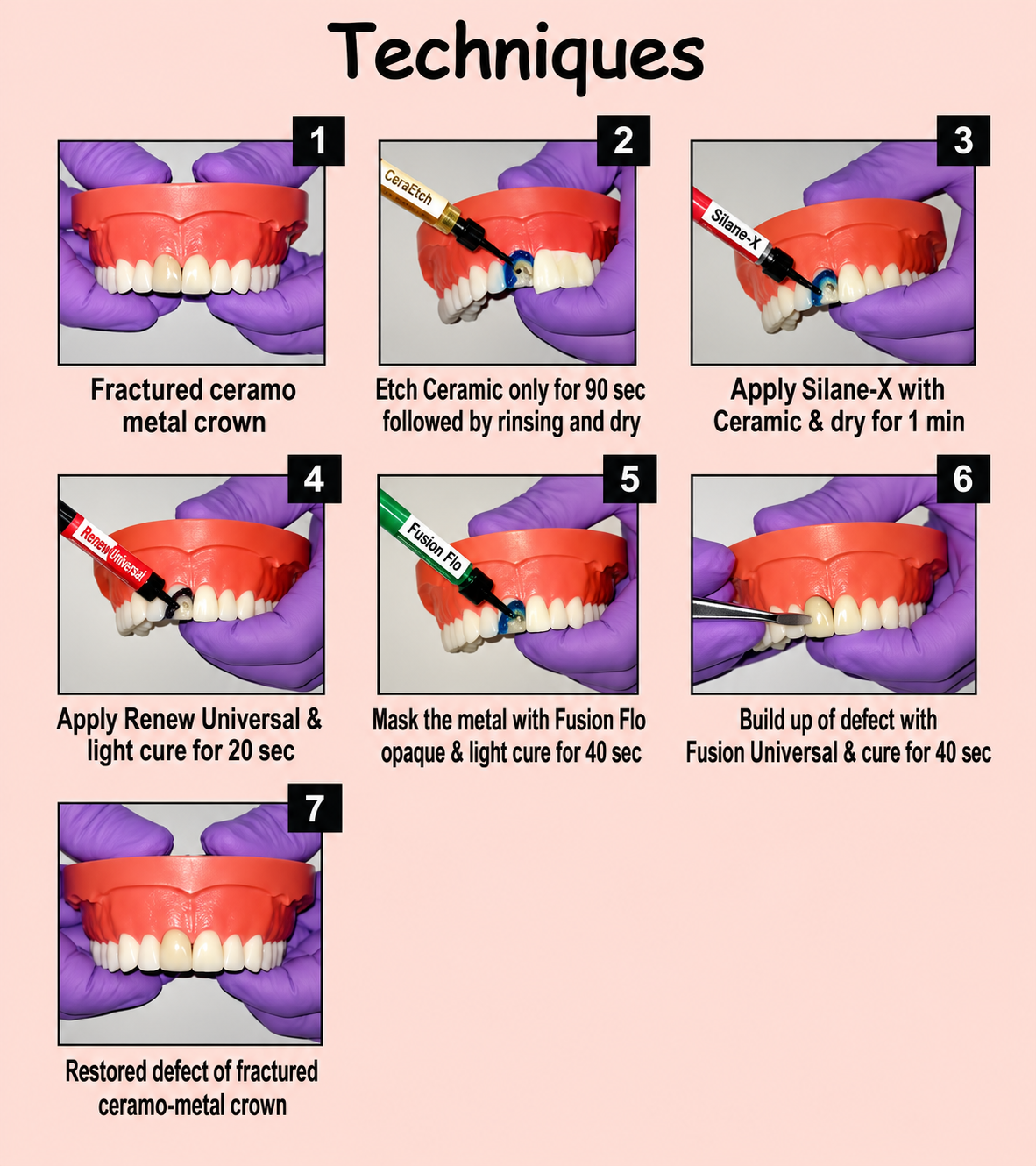 Prevest Denpro A.C.E Ceramic Repair Kit