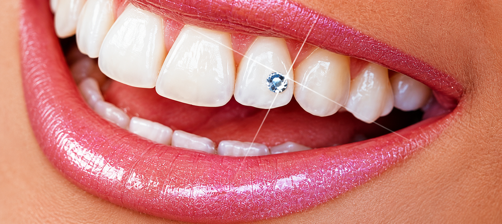 Ivoclar Skyce Tooth Diamond